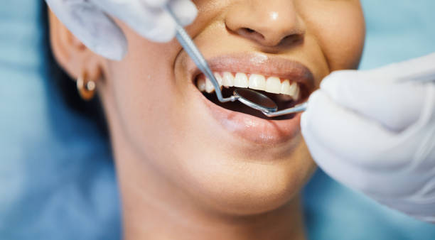 Best Emergency Gum Treatment in Delray Beach, FL